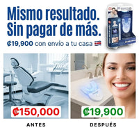 KIT DE BLANQUEAMIENTO DENTAL